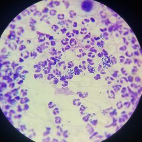 Meet your Posher, Lana - Picture 1 of 1